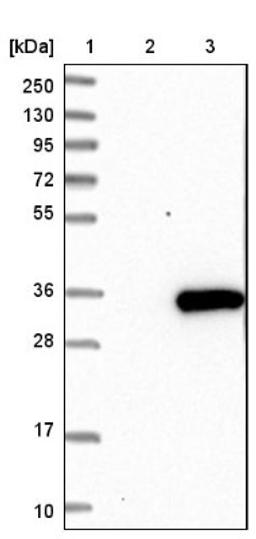 Western Blot: LRRC61 Antibody [NBP1-82021] - Lane 1: Marker [kDa] 250, 130, 95, 72, 55, 36, 28, 17, 10<br/>Lane 2: Negative control (vector only transfected HEK293T lysate)<br/>Lane 3: Over-expression lysate (Co-expressed with a C-terminal myc-DDK tag (~3.1 kDa) in mammalian HEK293T cells, LY411423)