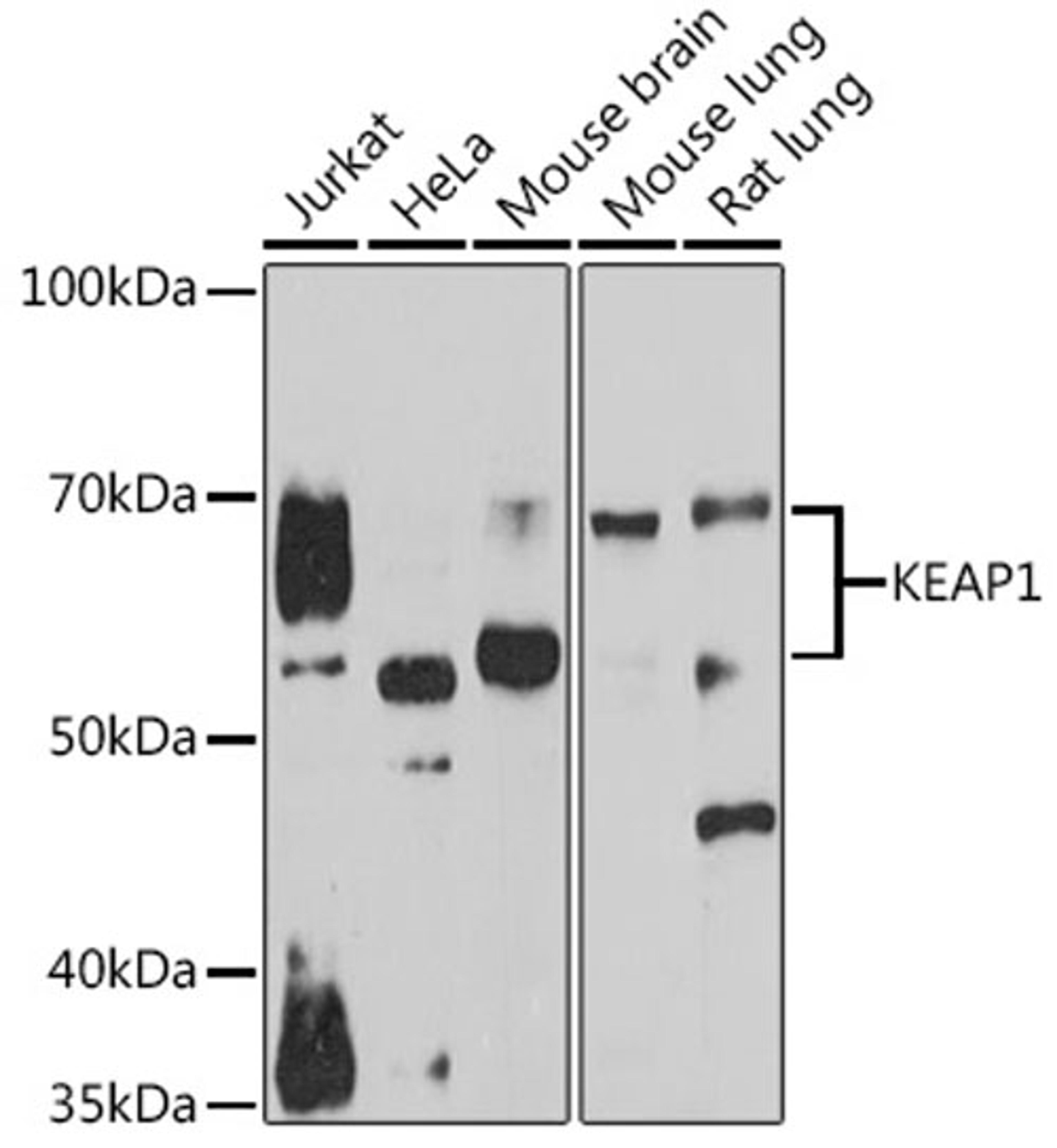 Western blot - KEAP1 antibody (A17061)