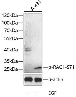 Western blot - Phospho-RAC1-S71 antibody (AP0086)