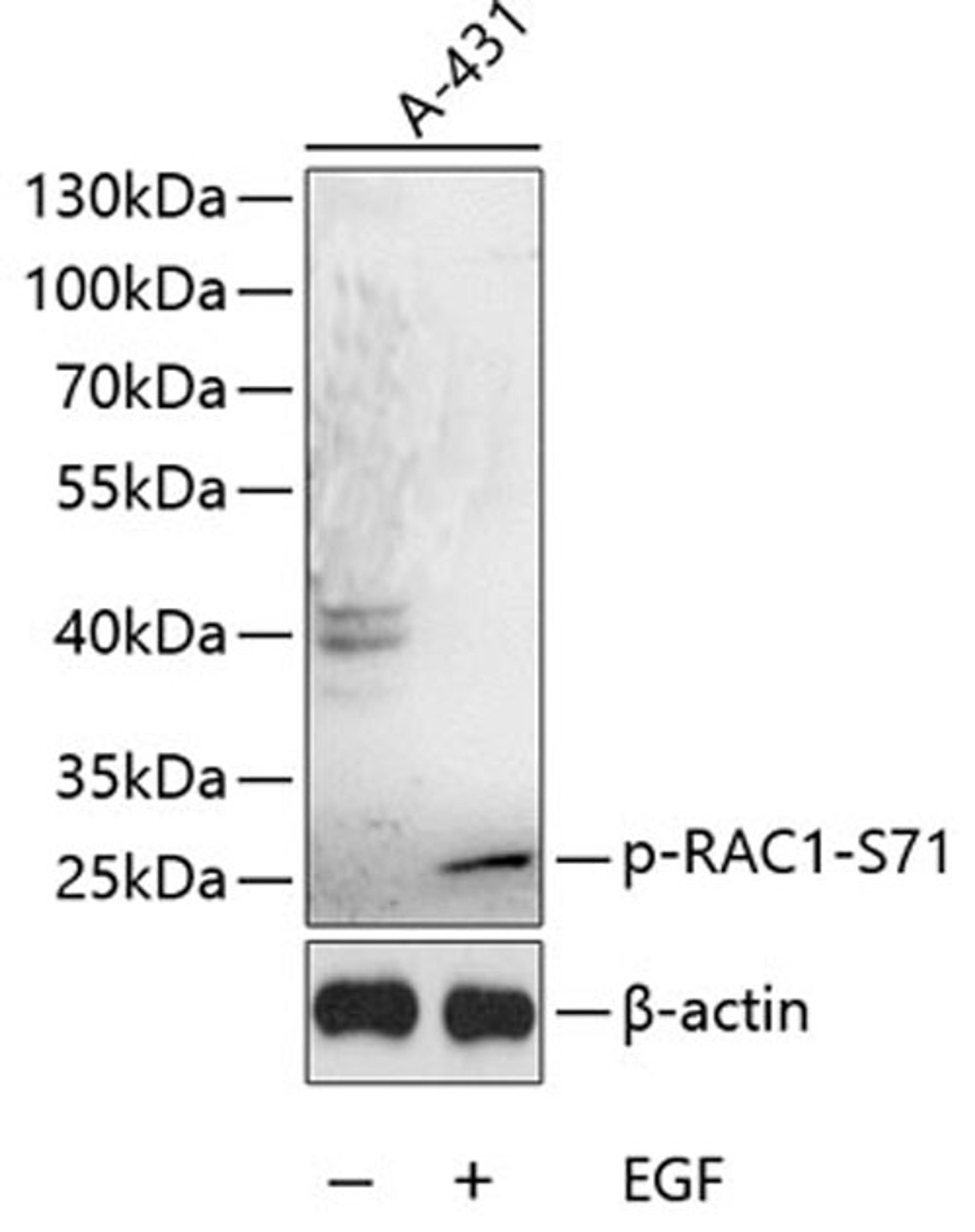 Western blot - Phospho-RAC1-S71 antibody (AP0086)