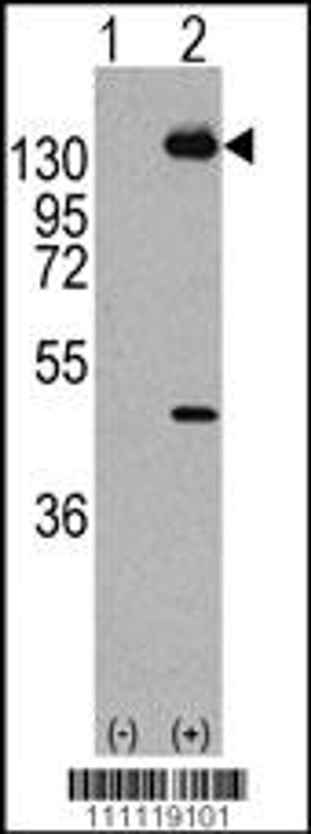 Western blot analysis of PDGFRA using rabbit polyclonal PDGFRA Antibody (Y768) using 293 cell lysates (2 ug/lane) either nontransfected (Lane 1) or transiently transfected with the PDGFRA gene (Lane 2).