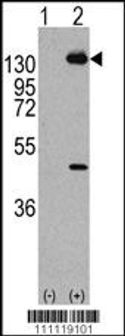 Western blot analysis of PDGFRA using rabbit polyclonal PDGFRA Antibody (Y768) using 293 cell lysates (2 ug/lane) either nontransfected (Lane 1) or transiently transfected with the PDGFRA gene (Lane 2).