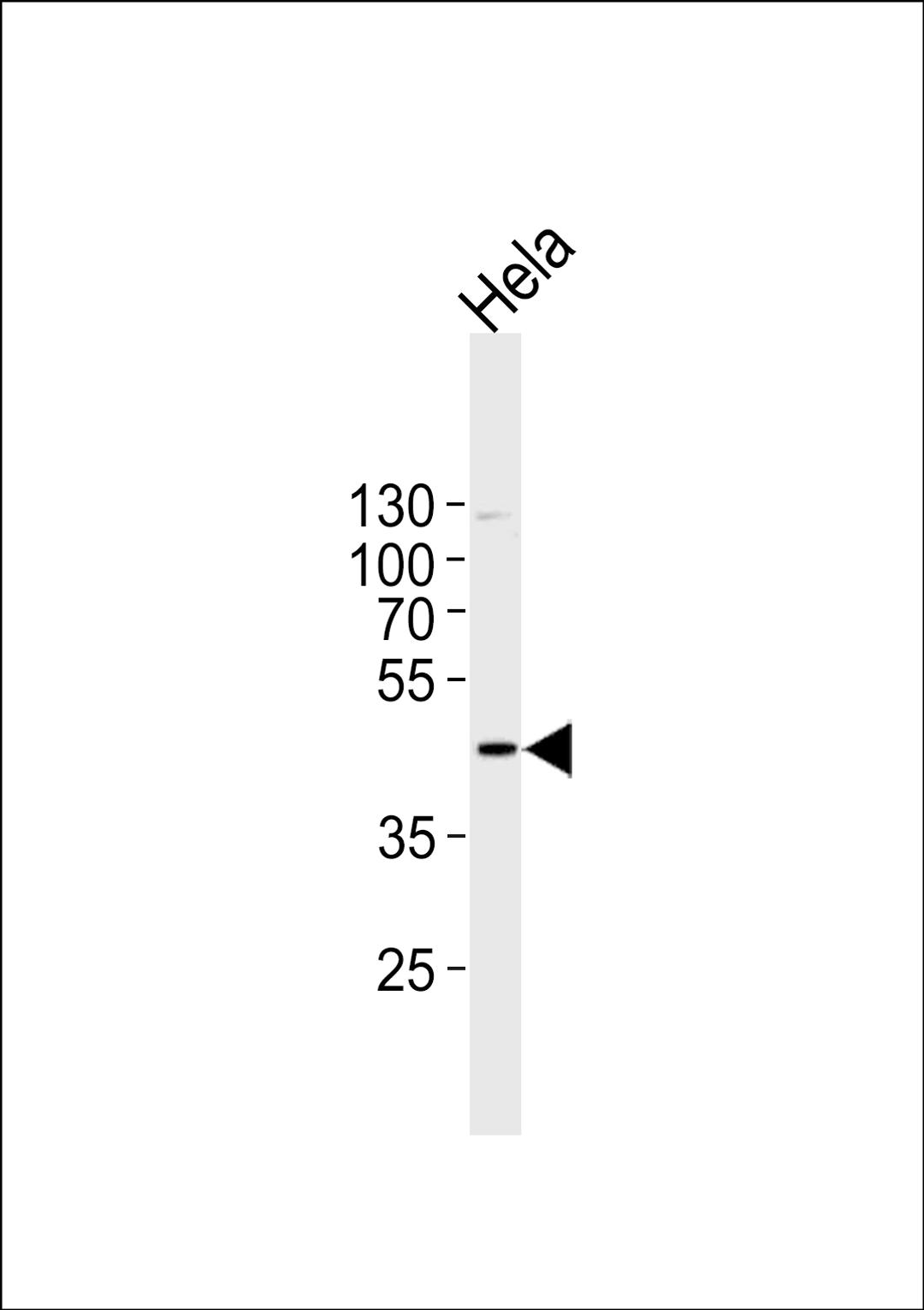 Western blot analysis in Hela cell line lysates (35ug/lane).