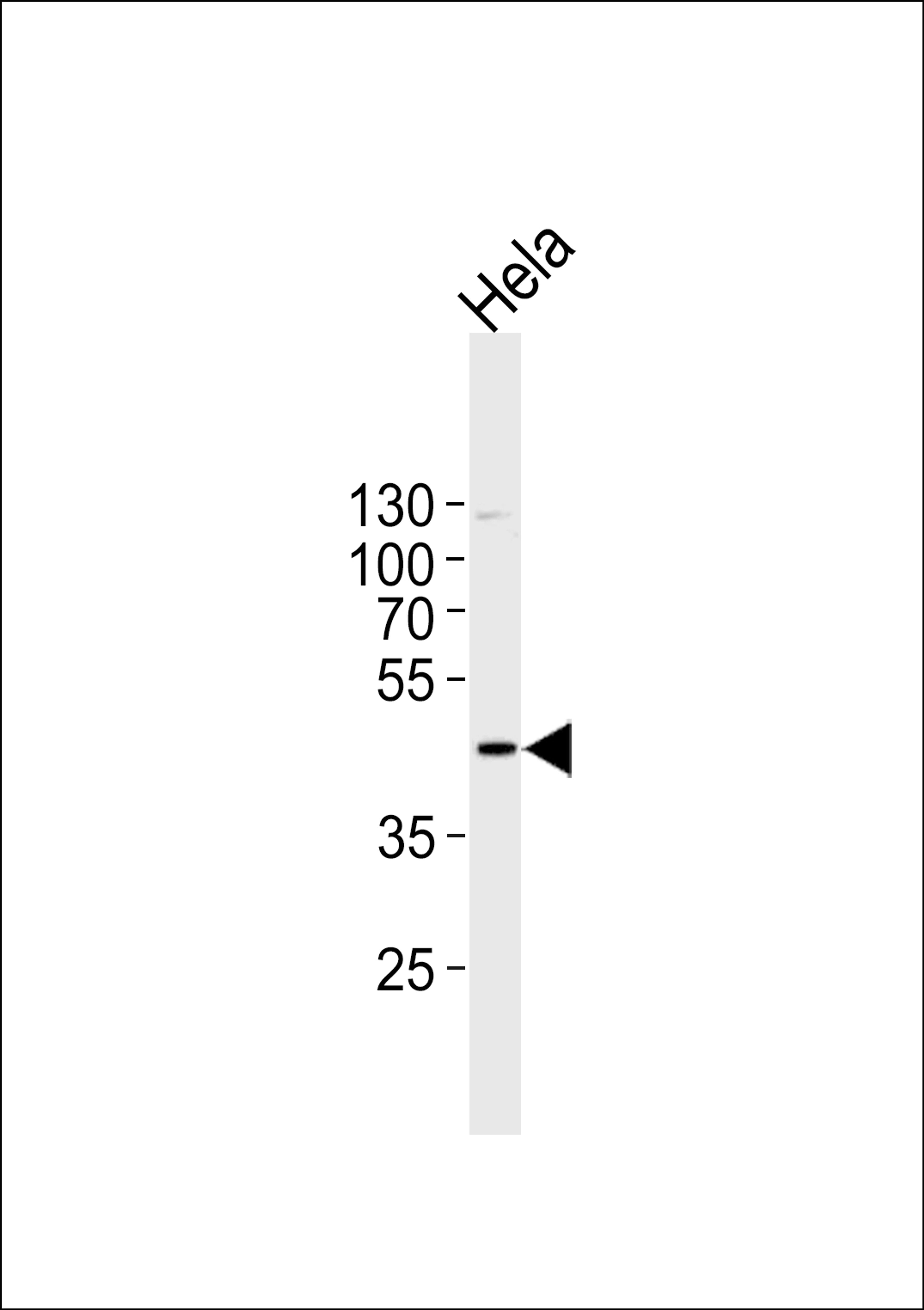 Western blot analysis in Hela cell line lysates (35ug/lane).