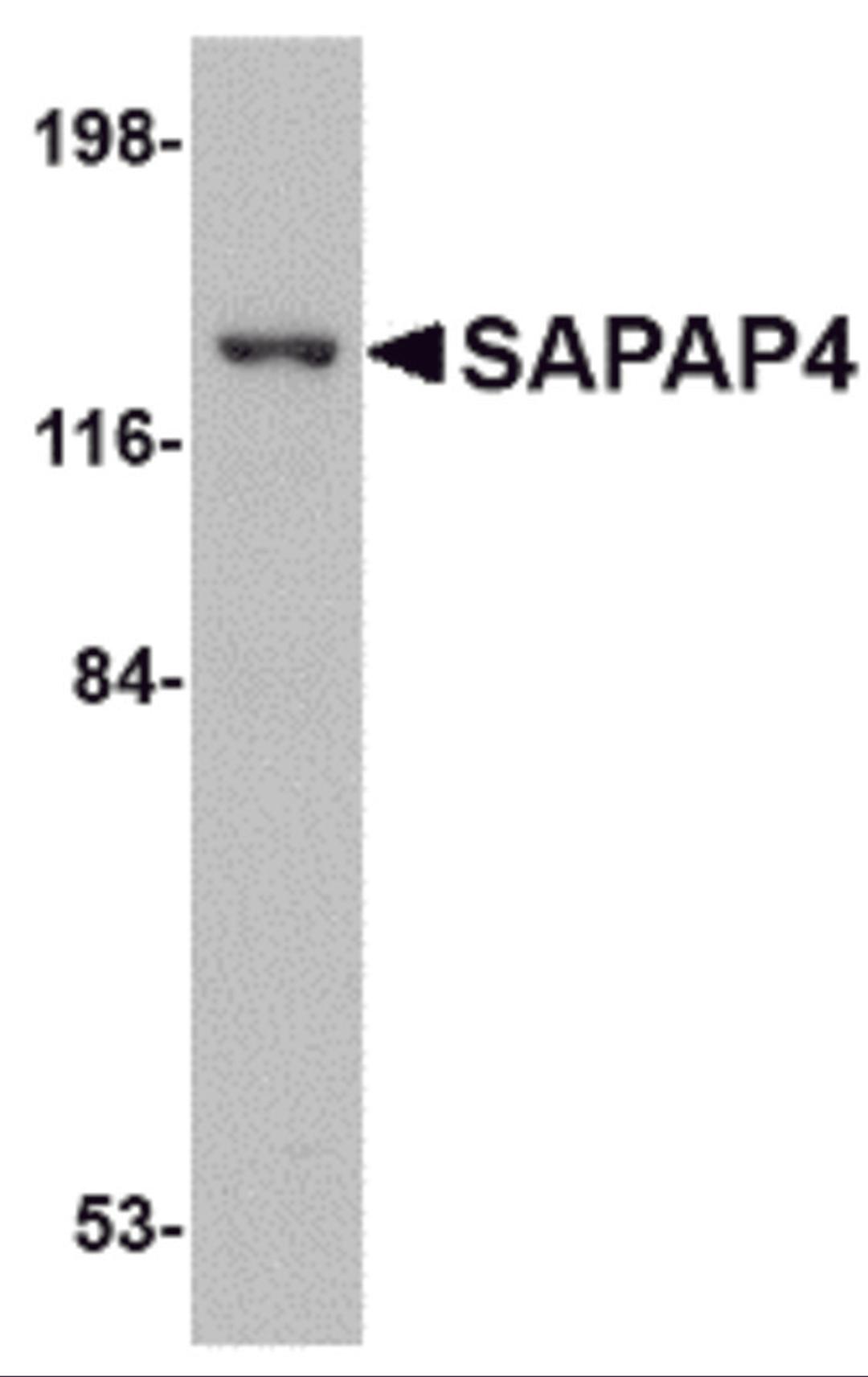 Western blot analysis of SAPAP4 in SK-N-SH cell lysate with SAPAP4 antibody at 1 μg/mL.