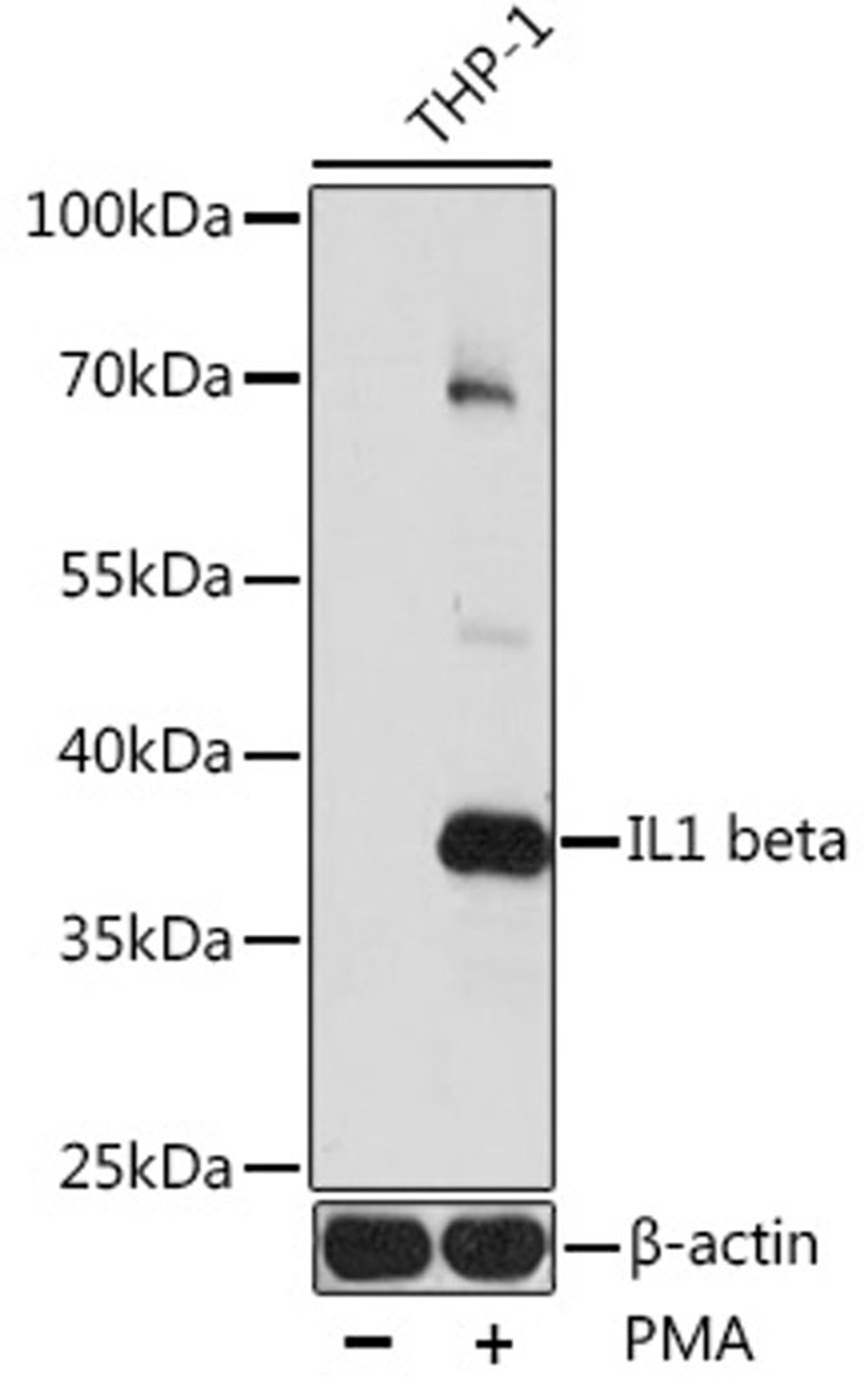 Western blot - IL1 beta antibody (A11370)