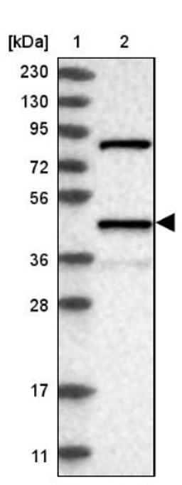 Western Blot: VIP Receptor 1 Antibody [NBP1-89640] - Lane 1: Marker [kDa] 230, 130, 95, 72, 56, 36, 28, 17, 11<br/>Lane 2: Human cell line RT-4