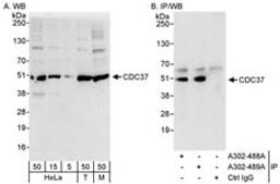 Detection of human and mouse CDC37 by western blot (h&m) and immunoprecipitation (h).