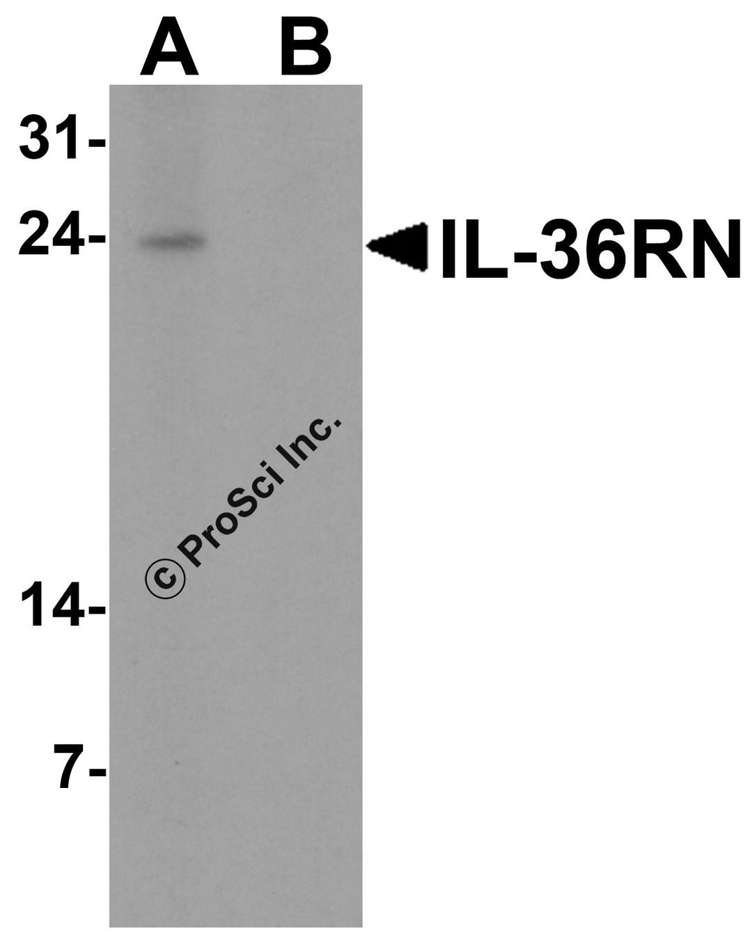 Western blot analysis of IL-36RN in human spleen tissue lysate with IL-36RN antibody at 1 μg/ml in (A) the absence and (B) the presence of blocking peptide.