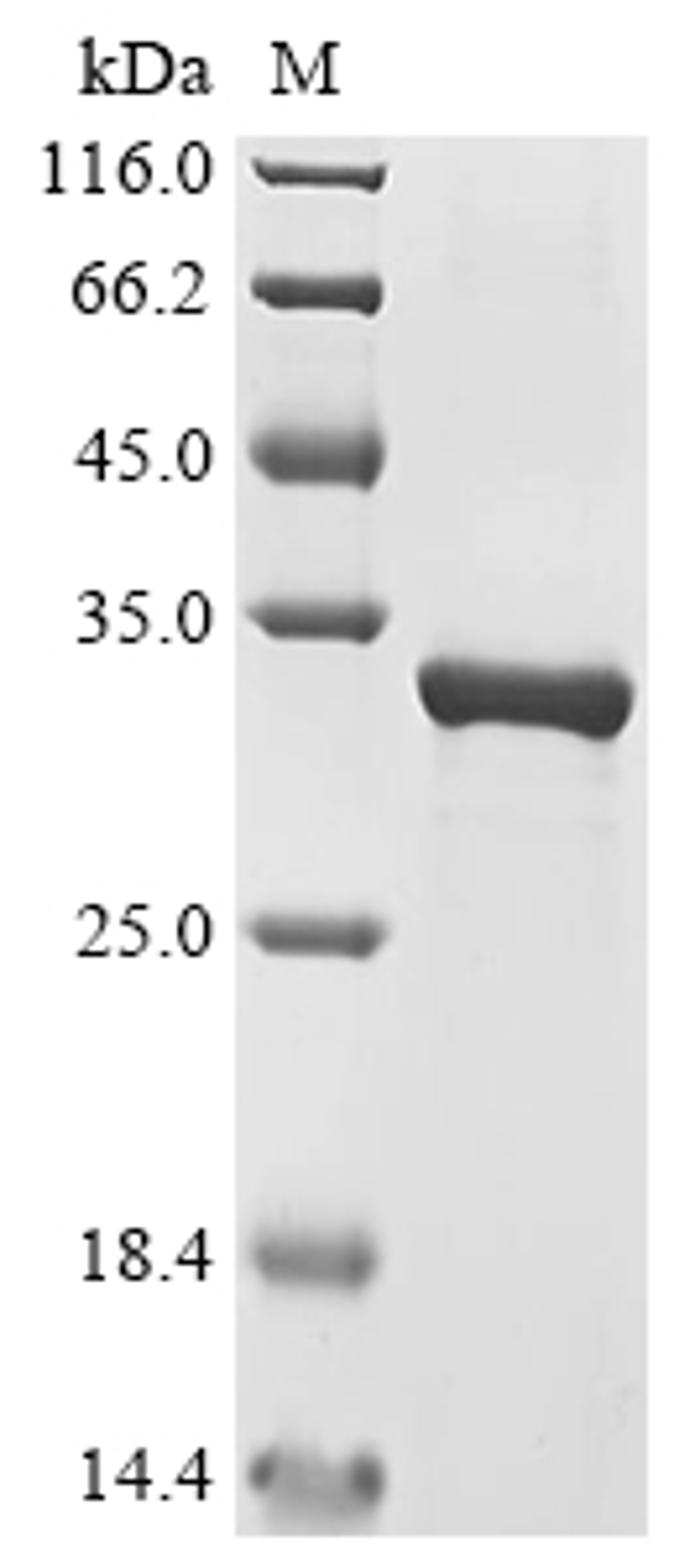 (Tris-Glycine gel) Discontinuous SDS-PAGE (reduced) with 5% enrichment gel and 15% separation gel.