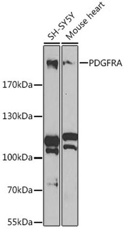 Western blot - PDGFRA antibody (A2103)