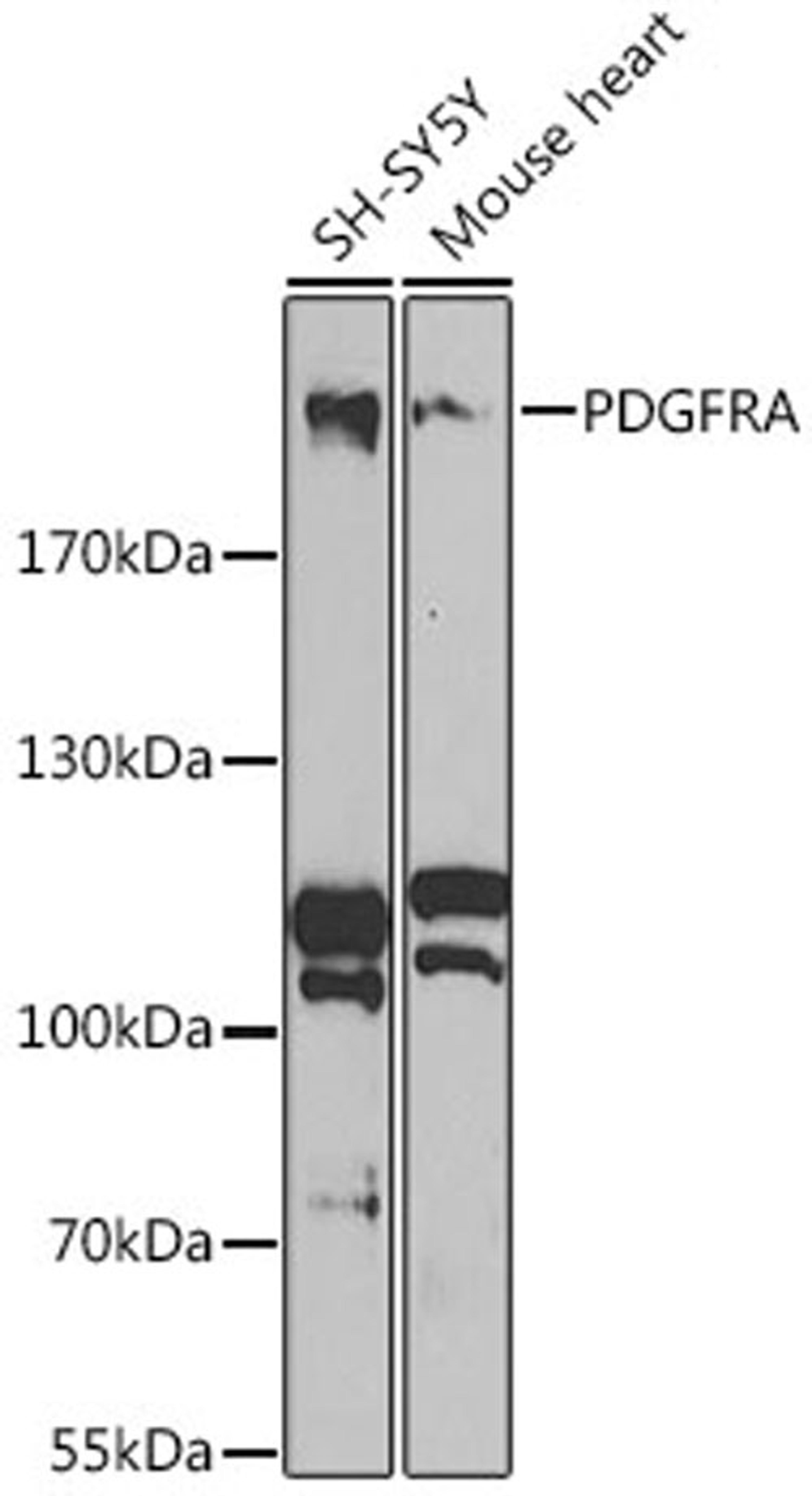 Western blot - PDGFRA antibody (A2103)