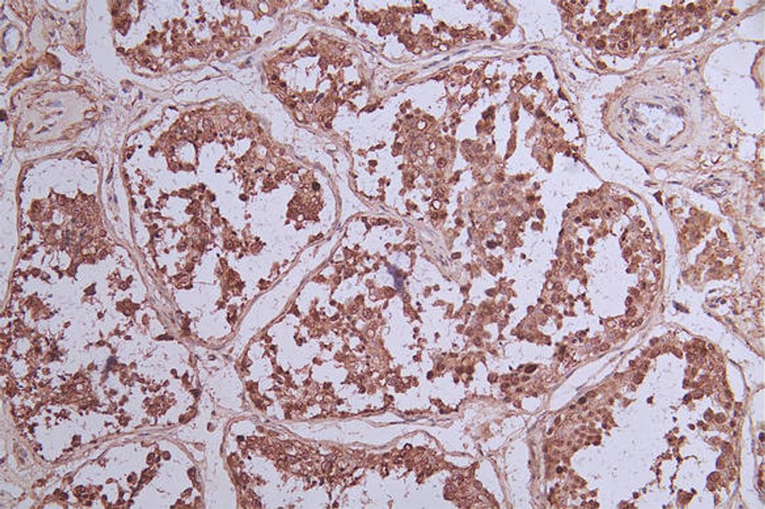 IHC image of CSB-RA131953A0HU diluted at 1:33 and staining in paraffin-embedded human testis tissue performed on a Leica BondTM system. After dewaxing and hydration, antigen retrieval was mediated by high pressure in a citrate buffer (pH 6.0). Section was blocked with 10% normal goat serum 30min at RT. Then primary antibody (1% BSA) was incubated at 4°C overnight. The primary is detected by a Goat anti-rabbit polymer IgG labeled by HRP and visualized using 0.73% DAB.
