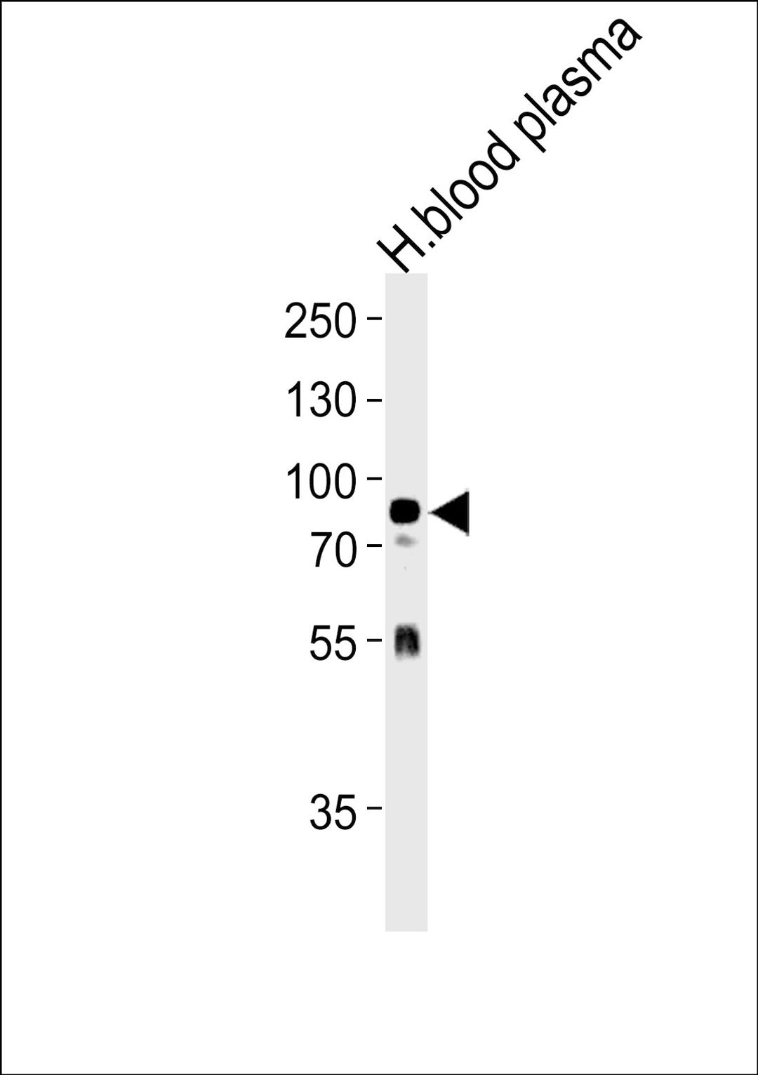 Western blot analysis in human blood plasma tissue lysates (35ug/lane).