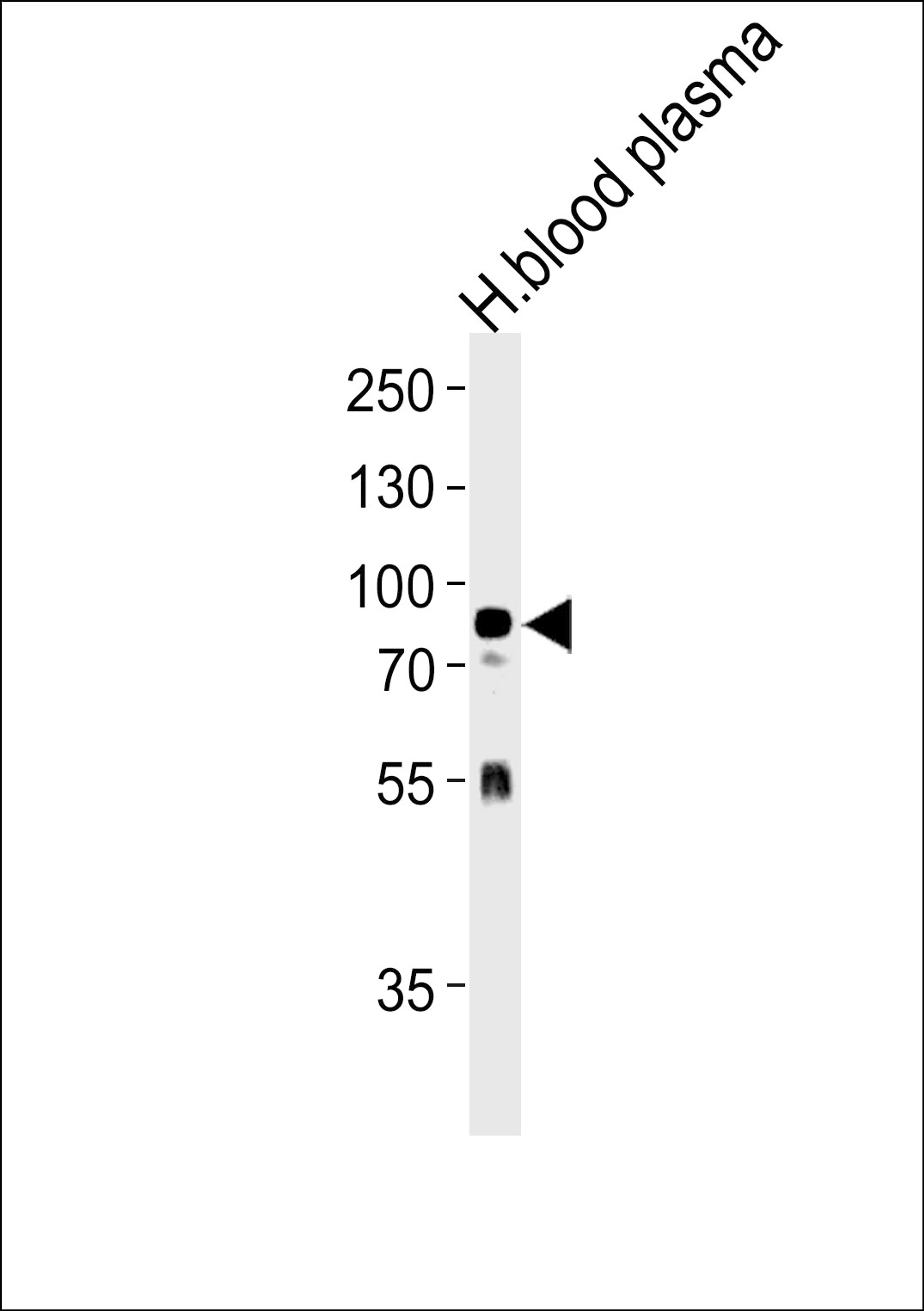 Western blot analysis in human blood plasma tissue lysates (35ug/lane).