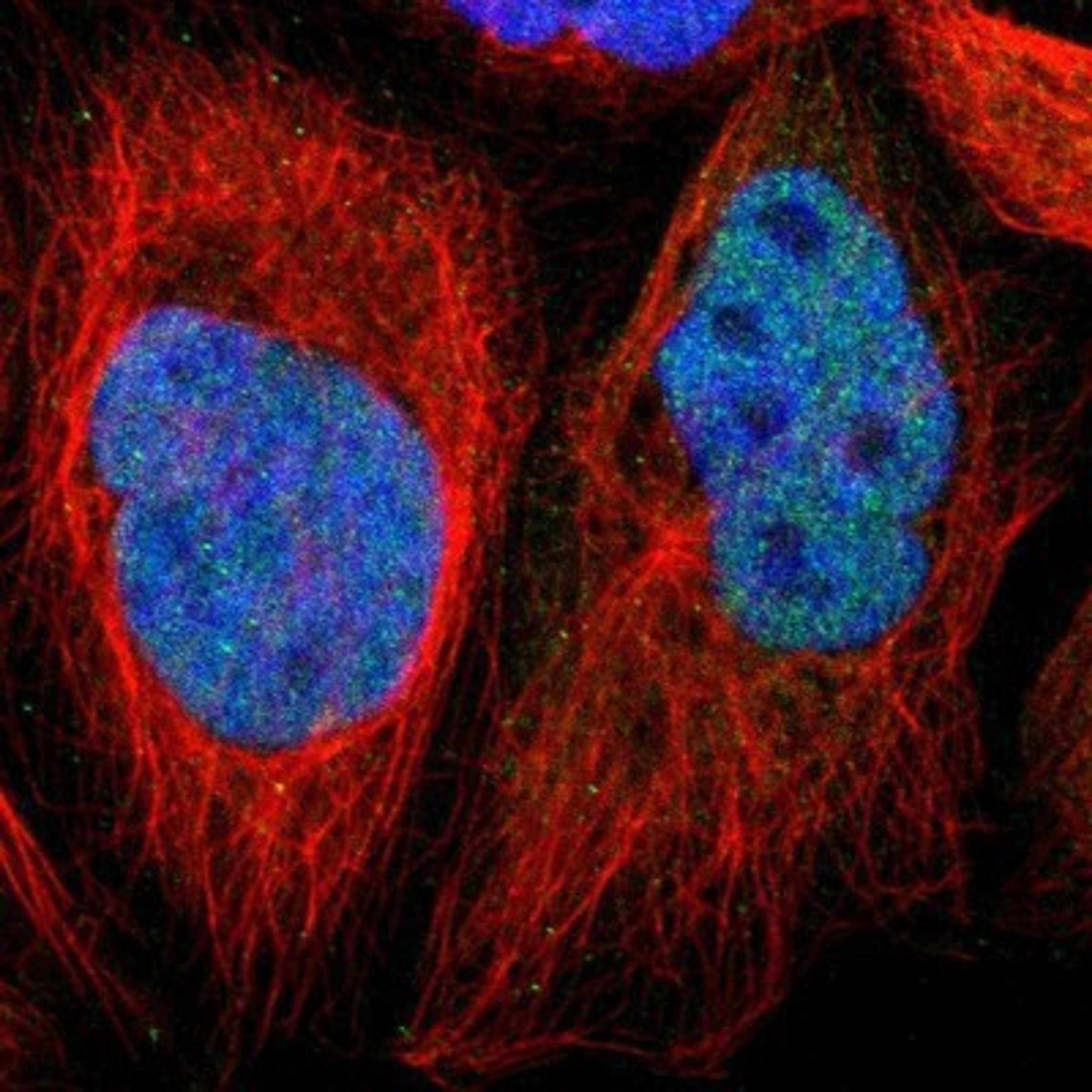 Immunocytochemistry/Immunofluorescence: DKC1 Antibody [NBP1-85156] - Staining of human cell line A-431 shows positivity in nuclei but not nucleoli.