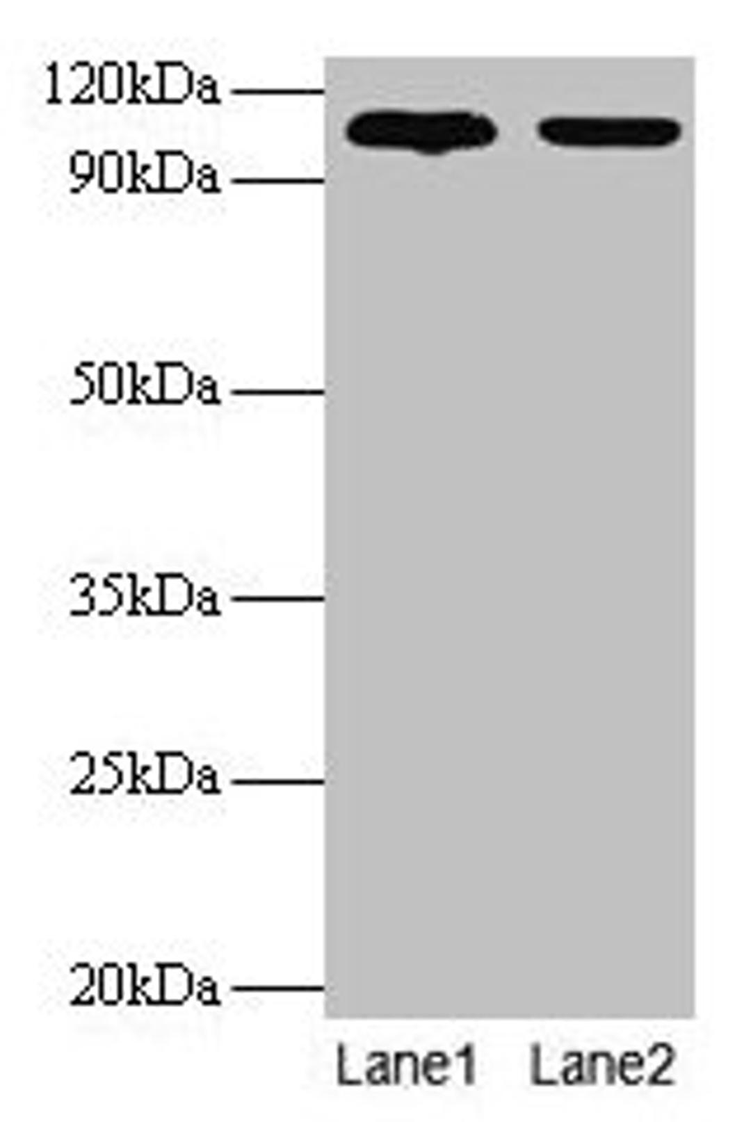 Western blot. All lanes: EXTL3 antibody at 2µg/ml. Lane 1: EC109 whole cell lysate. Lane 2: 293T whole cell lysate. Secondary. Goat polyclonal to rabbit IgG at 1/15000 dilution. Predicted bane side: 105 kDa. Observed band side: 105 kDa