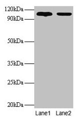 Western blot. All lanes: EXTL3 antibody at 2µg/ml. Lane 1: EC109 whole cell lysate. Lane 2: 293T whole cell lysate. Secondary. Goat polyclonal to rabbit IgG at 1/15000 dilution. Predicted bane side: 105 kDa. Observed band side: 105 kDa