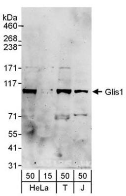 Detection of human Glis1 by western blot.