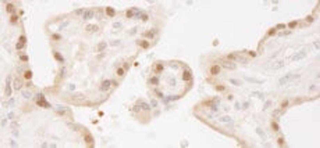 Detection of human MST1 and MST2 by immunohistochemistry.