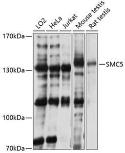 Western blot - SMC5 antibody (A2301)