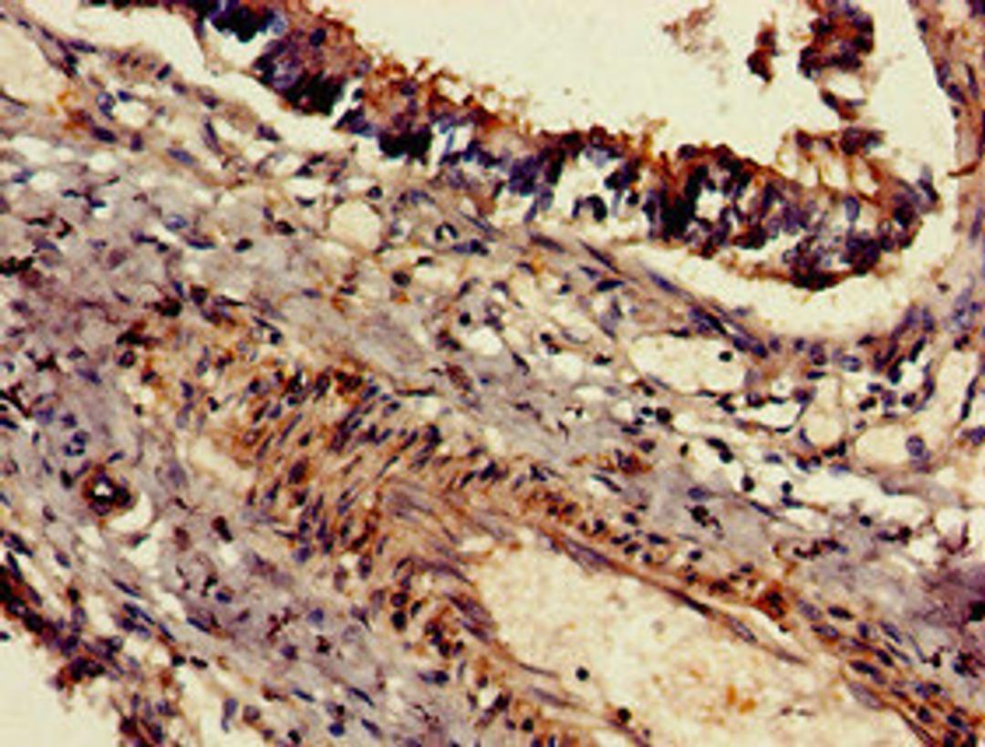 Immunohistochemistry of paraffin-embedded human lung tissue using CSB-PA819476LA01HU at dilution of 1:100