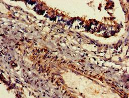 Immunohistochemistry of paraffin-embedded human lung tissue using CSB-PA819476LA01HU at dilution of 1:100