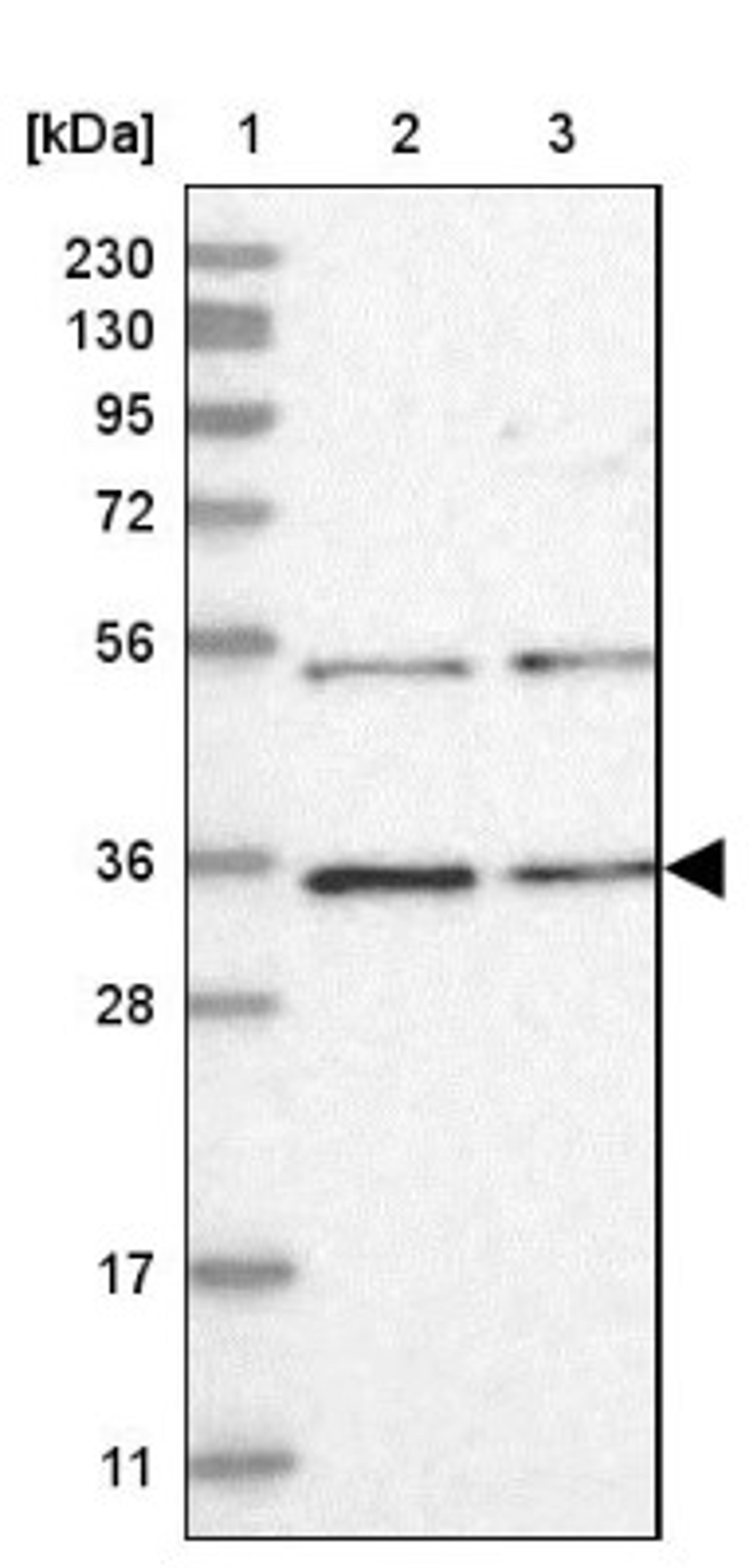 Western Blot: CSN7b Antibody [NBP1-85433] - Lane 1: Marker [kDa] 230, 130, 95, 72, 56, 36, 28, 17, 11<br/>Lane 2: Human cell line RT-4<br/>Lane 3: Human cell line U-251MG sp