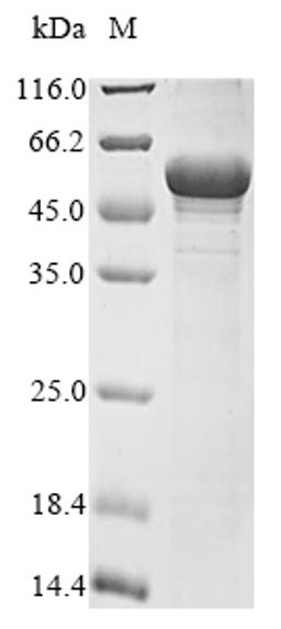 (Tris-Glycine gel) Discontinuous SDS-PAGE (reduced) with 5% enrichment gel and 15% separation gel.