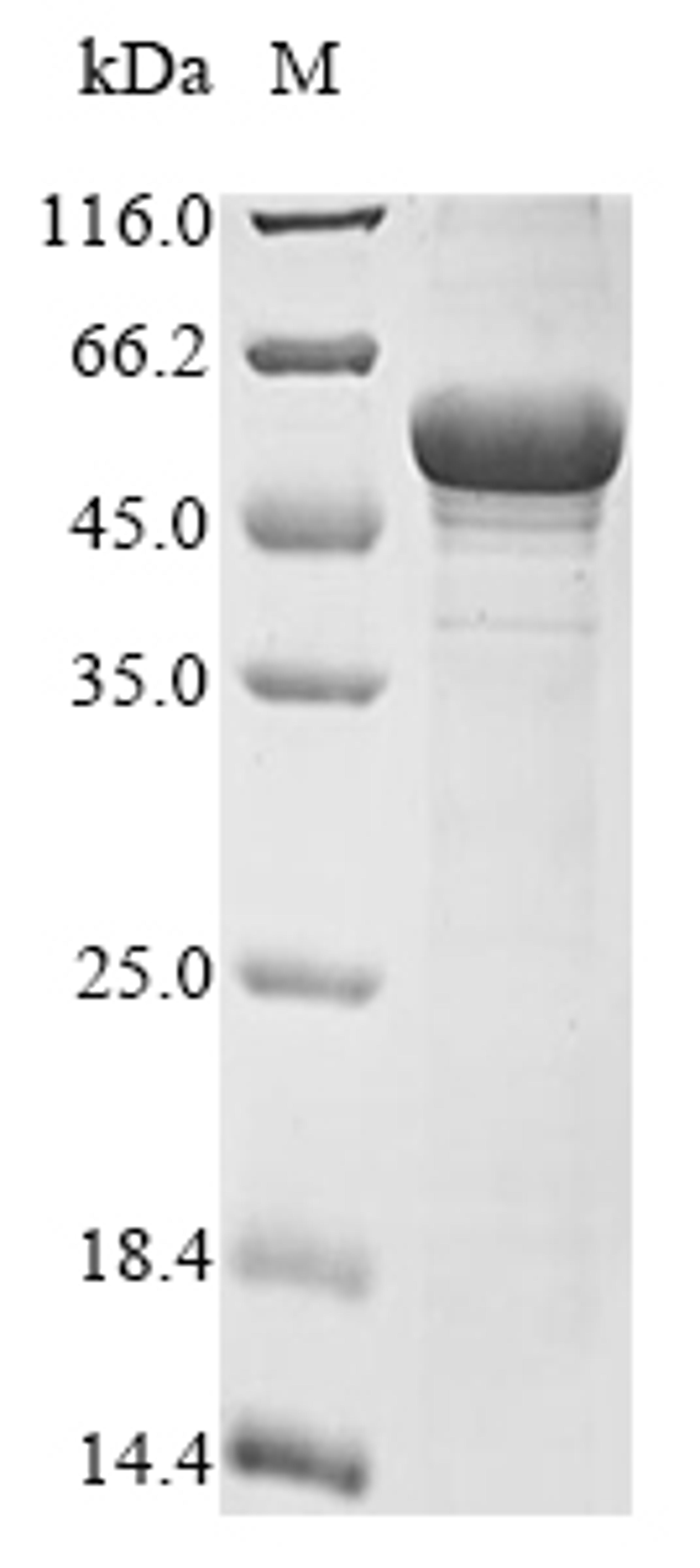 (Tris-Glycine gel) Discontinuous SDS-PAGE (reduced) with 5% enrichment gel and 15% separation gel.