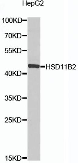 Western blot - HSD11B2 antibody (A8077)