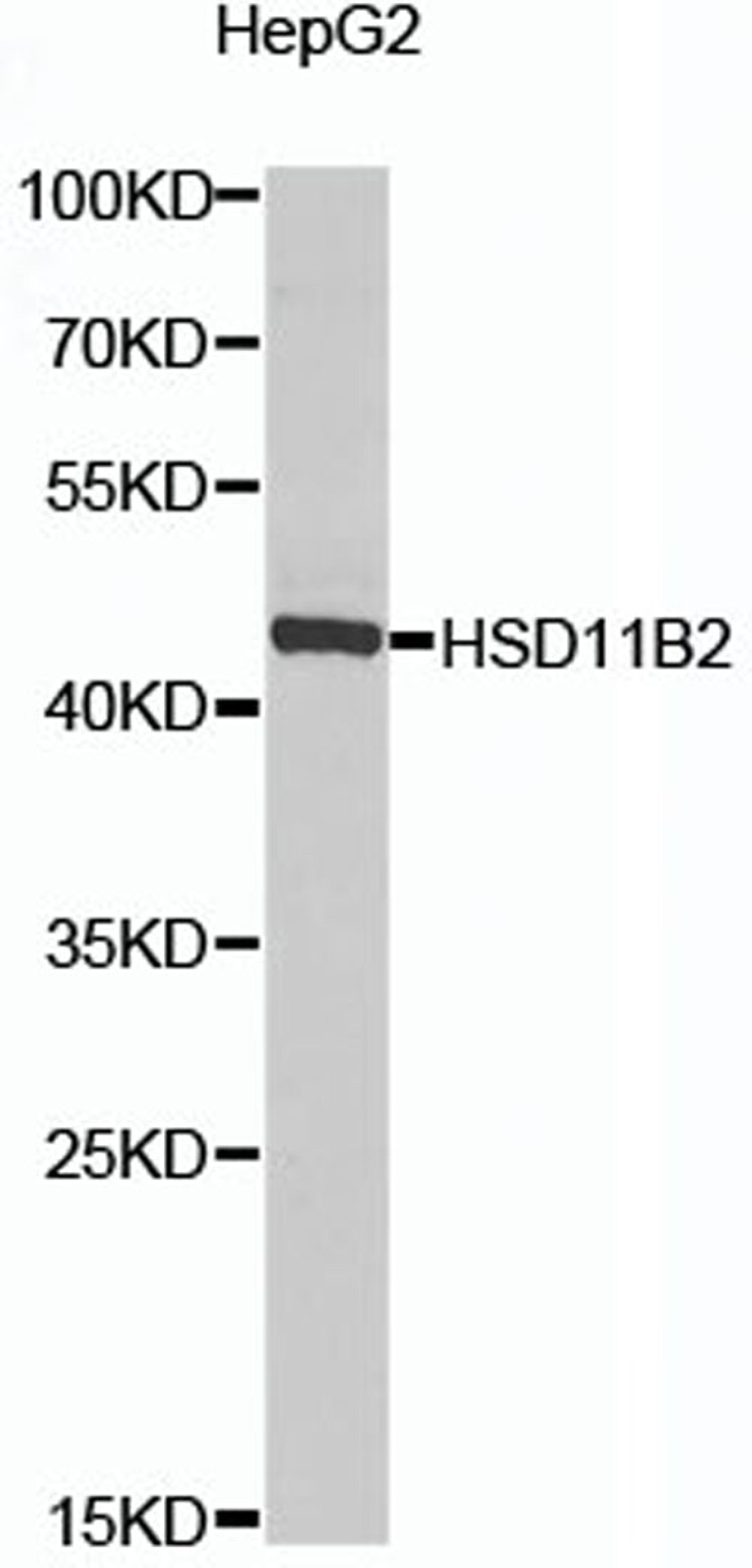 Western blot - HSD11B2 antibody (A8077)