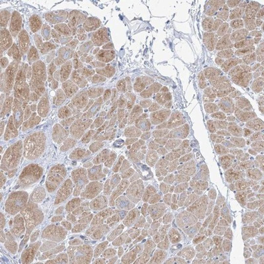 Immunohistochemistry-Paraffin: FAM184A Antibody [NBP1-86741] - Staining of human heart muscle shows moderate cytoplasmic positivity in myocytes.