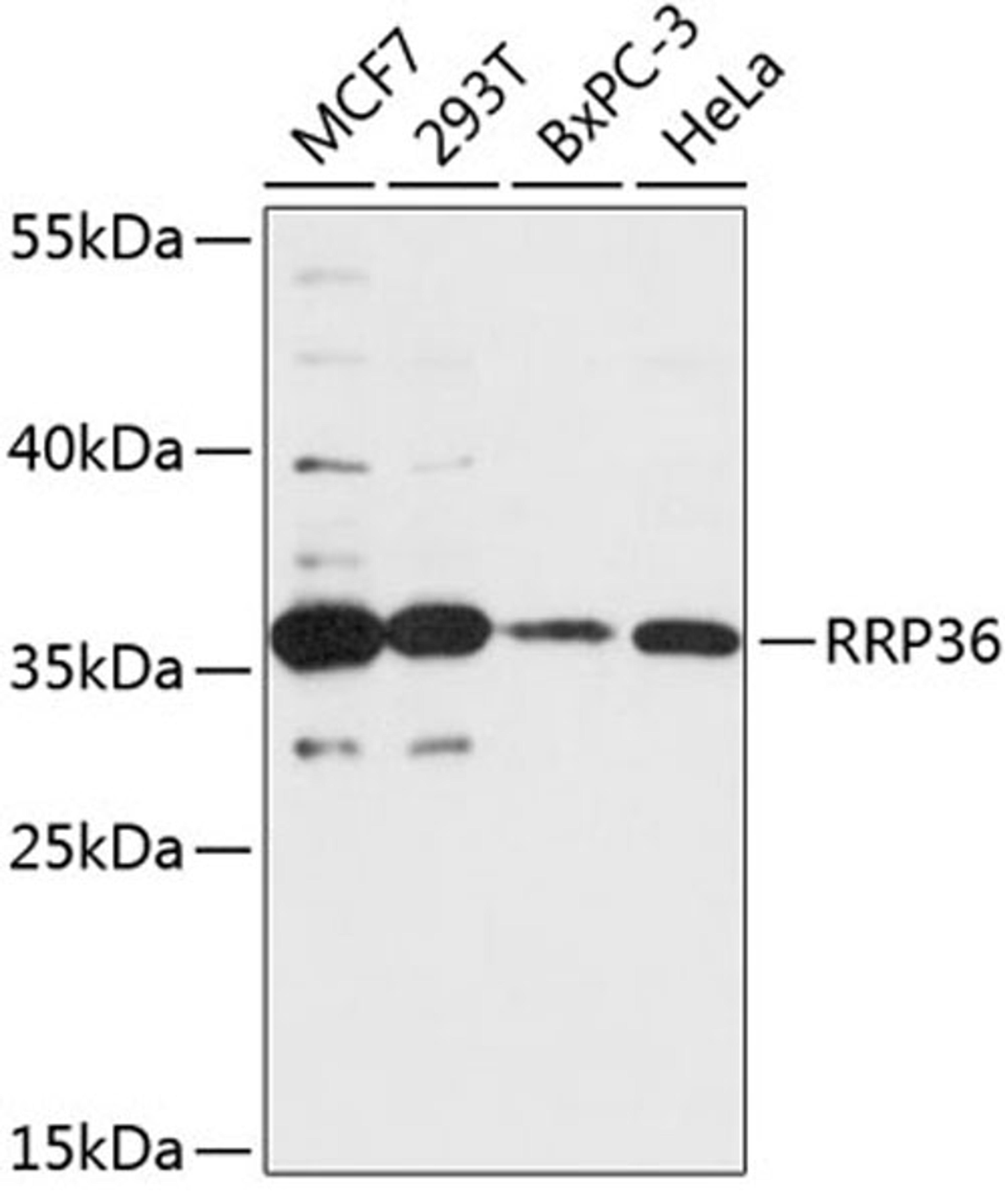 Western blot - RRP36 antibody (A14328)