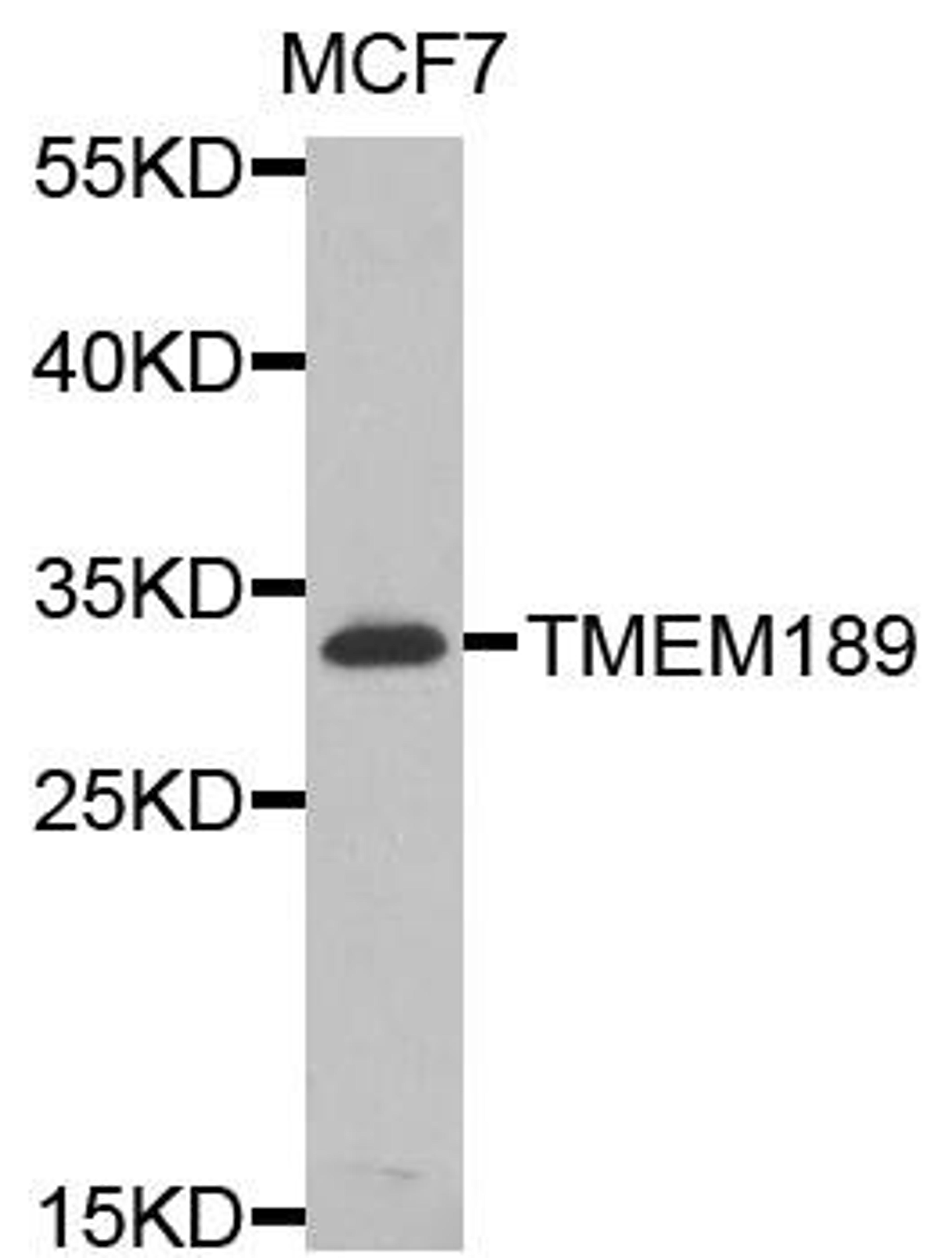 Western blot analysis of extracts of MCF7 cells using TMEM189 antibody