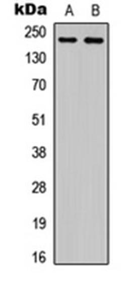 Western blot analysis of NS-1 (Lane 1), PC12 (Lane 2) whole cell lysates using Plexin A4 antibody