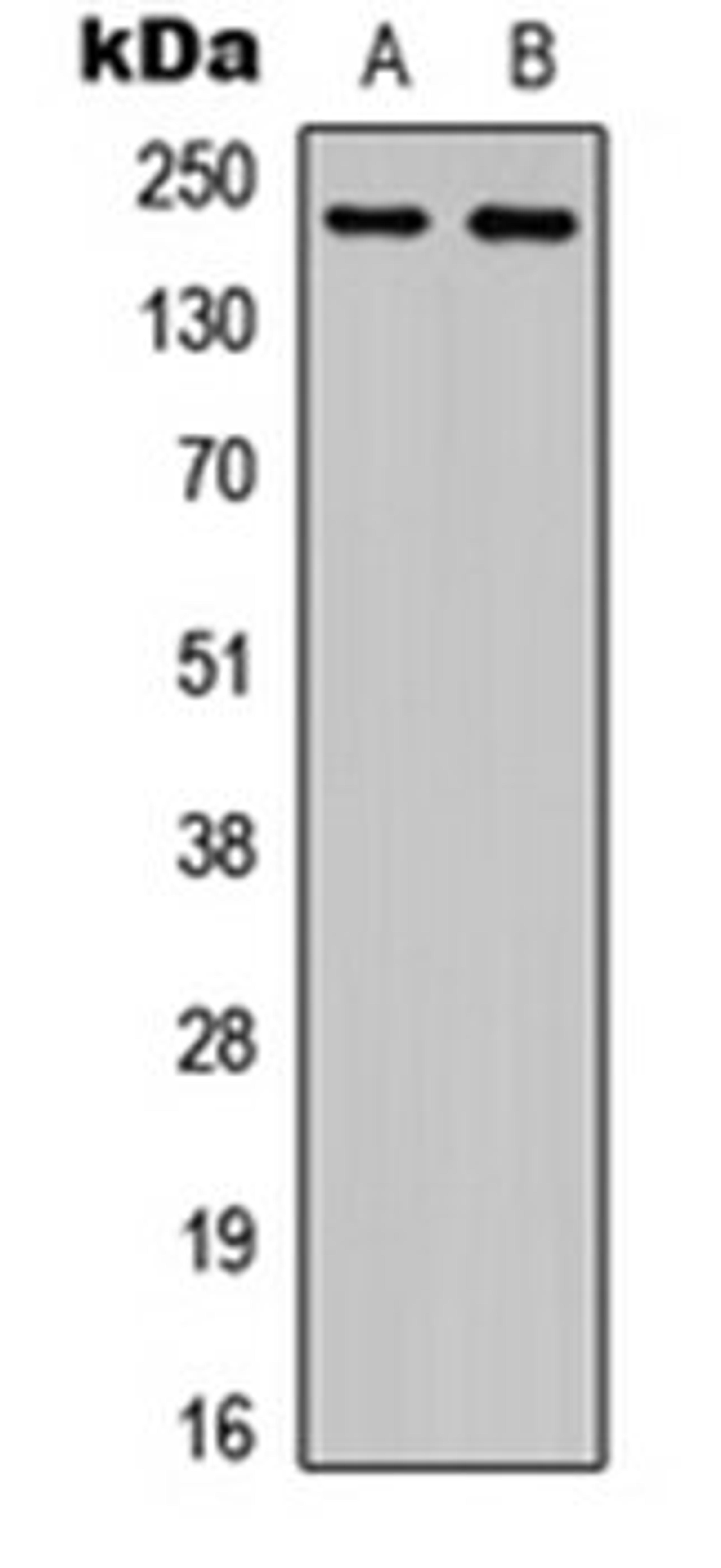 Western blot analysis of NS-1 (Lane 1), PC12 (Lane 2) whole cell lysates using Plexin A4 antibody