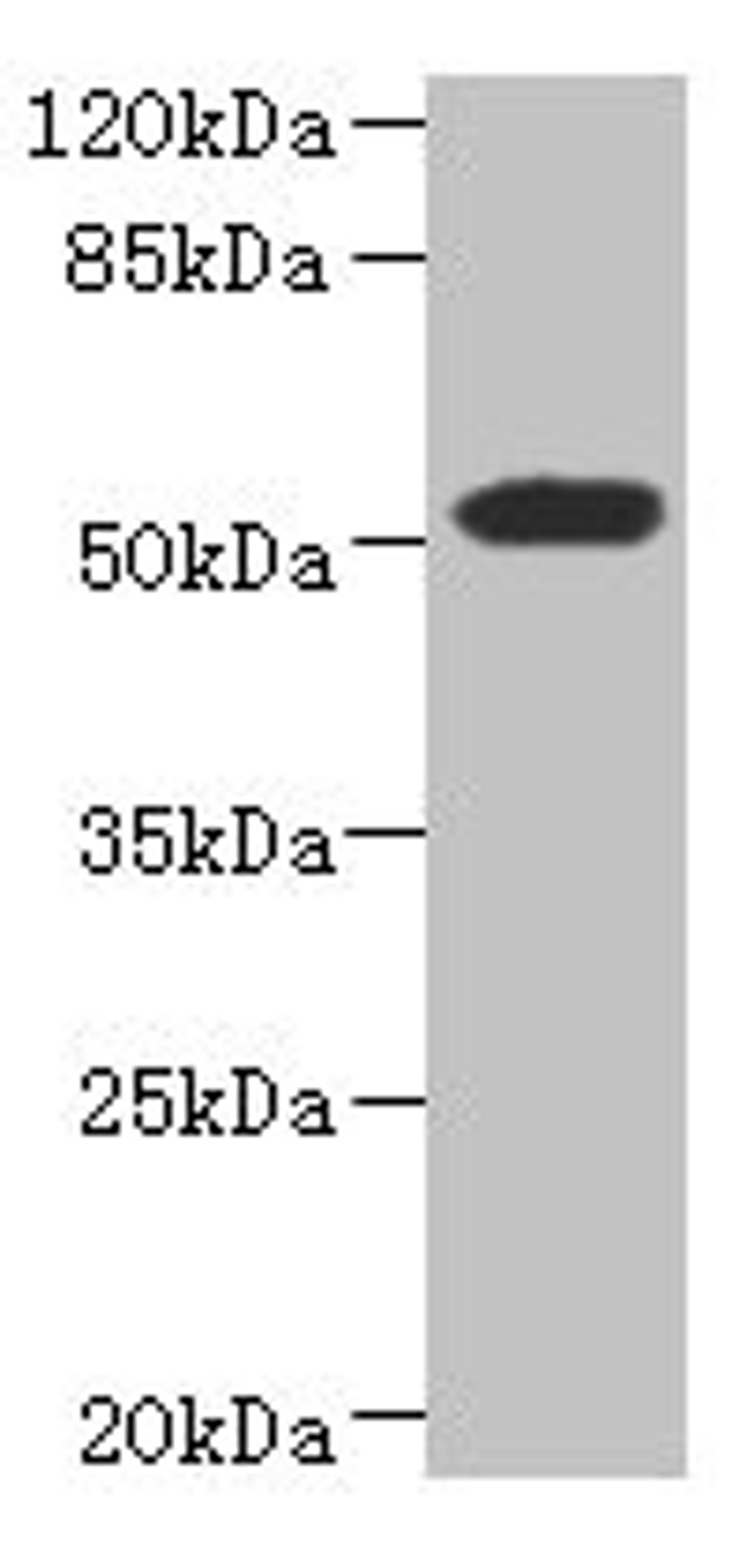 Western blot. All lanes: ASPSCR1 antibody at 8.71ug/ml + 293T whole cell lysate. Secondary. Goat polyclonal to rabbit IgG at 1/10000 dilution. Predicted band size: 61, 70, 55, 38 kDa. Observed band size: 61 kDa. 