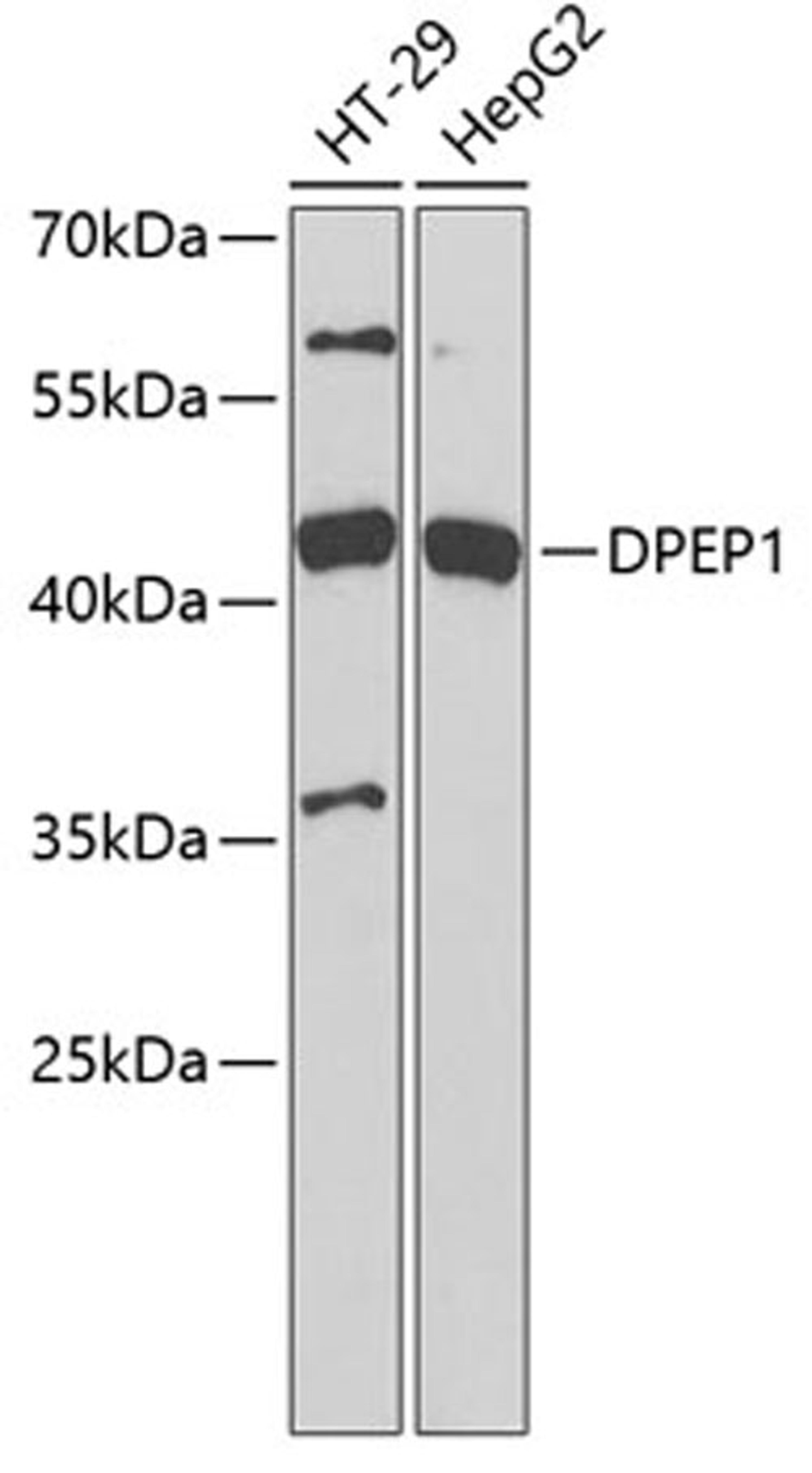 Western blot - DPEP1 antibody (A6289)