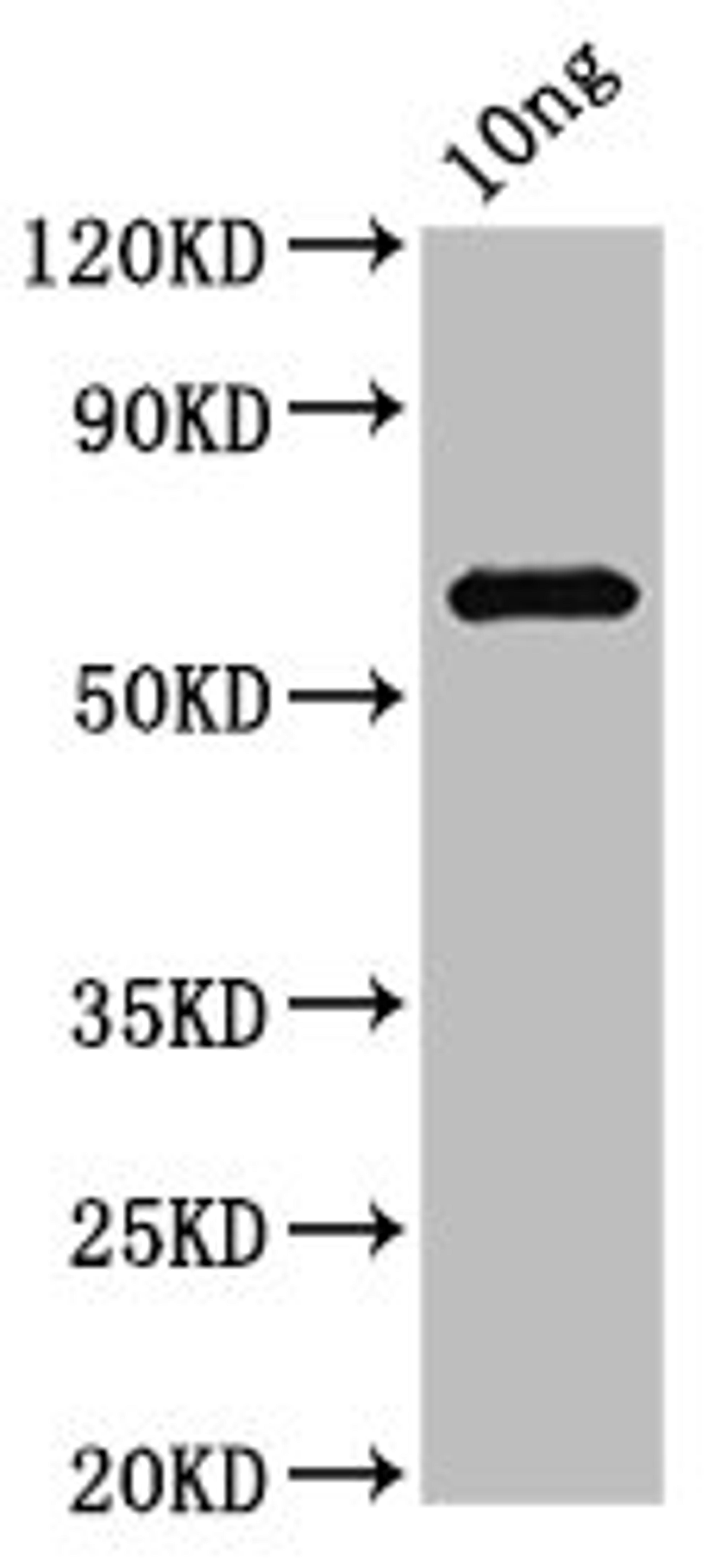 Western Blot. Positive WB detected in Recombinant protein. All lanes: PG_1424 antibody at 3.7ug/ml. Secondary. Goat polyclonal to rabbit IgG at 1/50000 dilution. Predicted band size: 63 kDa. Observed band size: 63 kDa.