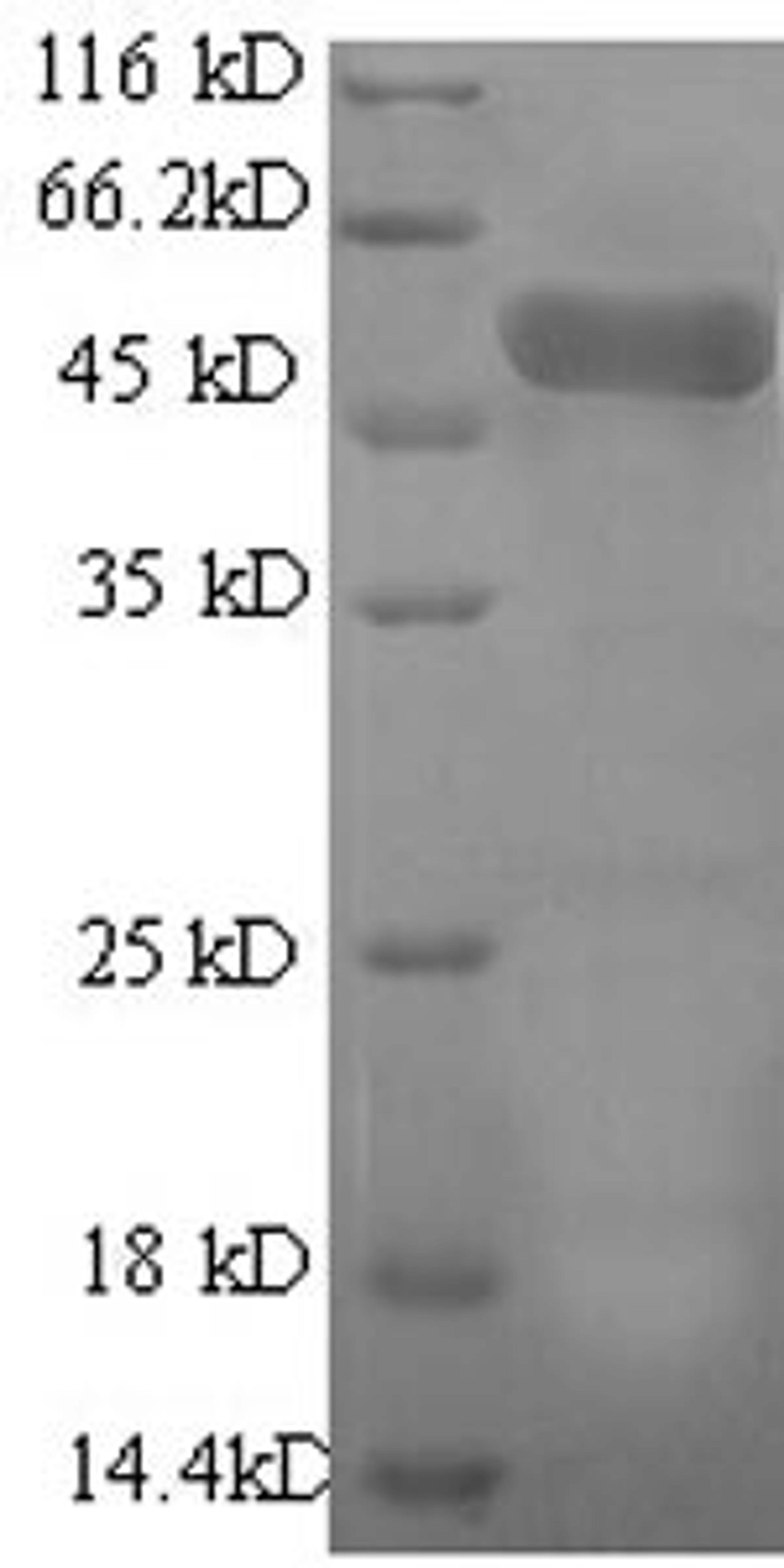 (Tris-Glycine gel) Discontinuous SDS-PAGE (reduced) with 5% enrichment gel and 15% separation gel.