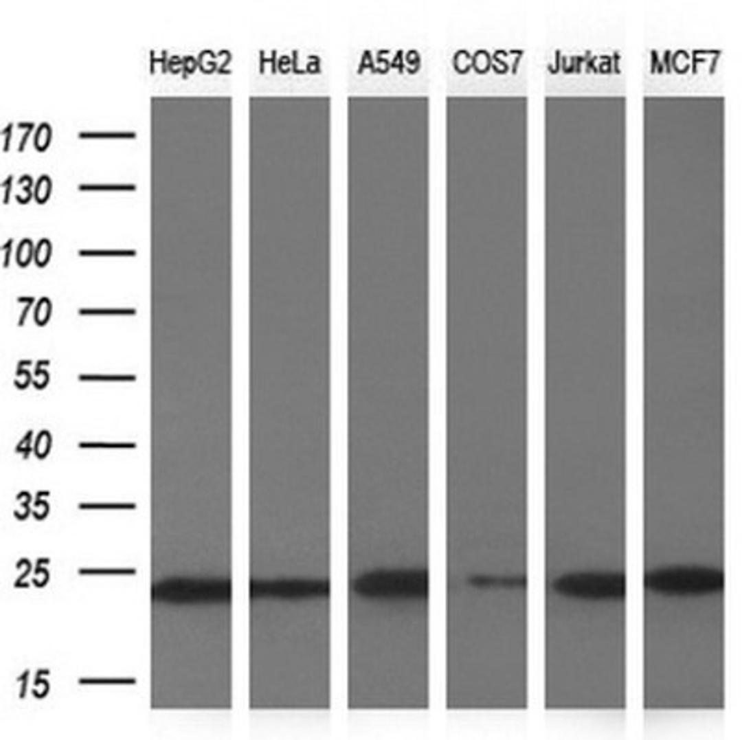 Western Blot: NDUFB9 Antibody (13H11) [NBP2-46126] - Analysis of extracts (10ug) from 6 different cell lines by using NDUFB9 monoclonal antibody.