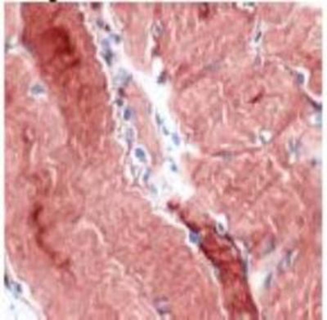 Immunohistochemistry-Paraffin: Desmin Antibody [NB120-15200] - Human skeletal muscle stained with anti-desmin antibody.