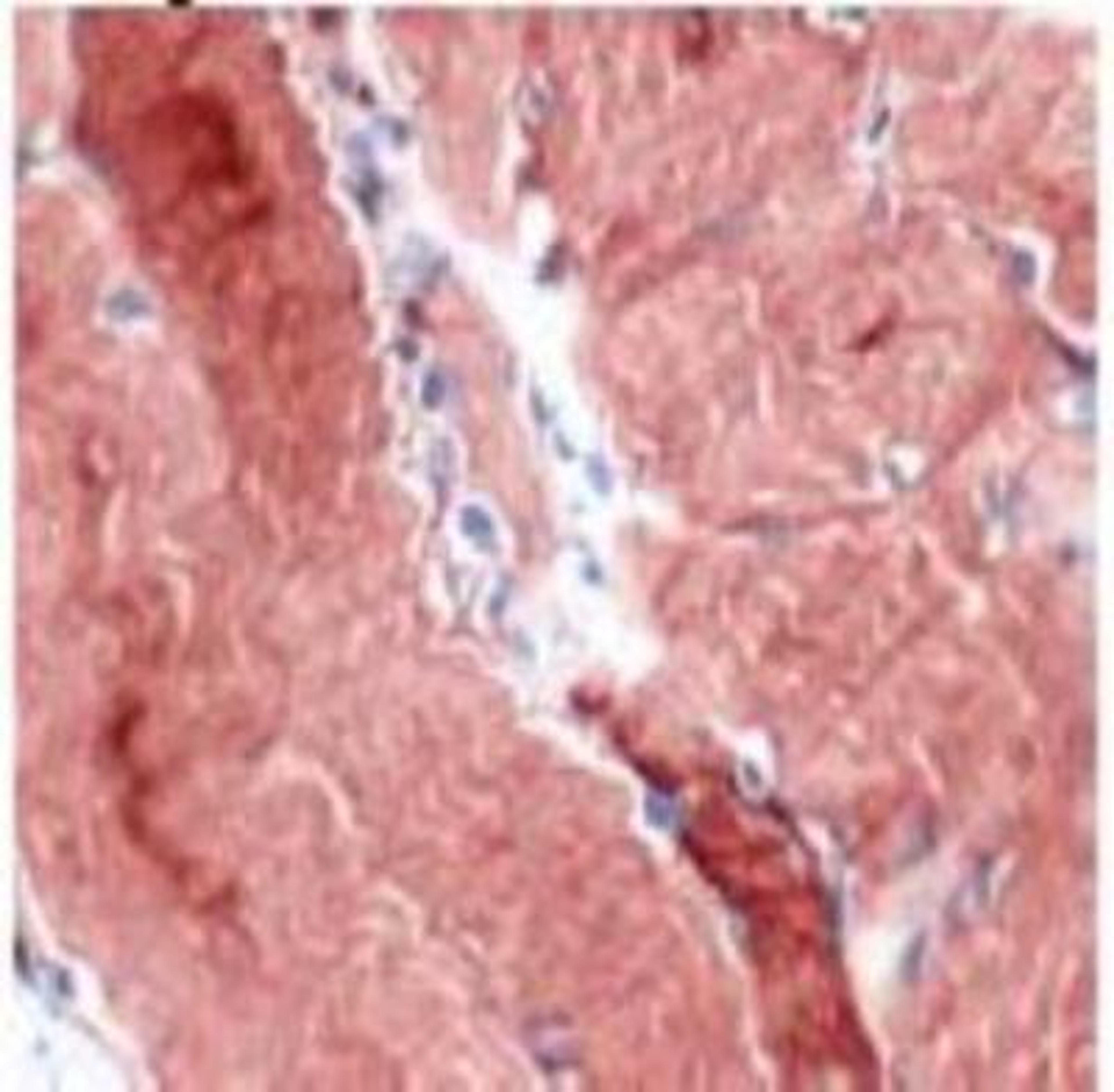 Immunohistochemistry-Paraffin: Desmin Antibody [NB120-15200] - Human skeletal muscle stained with anti-desmin antibody.