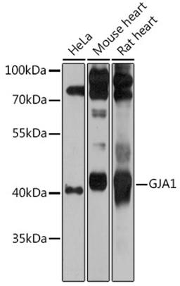 Western blot - GJA1 antibody (A11752)