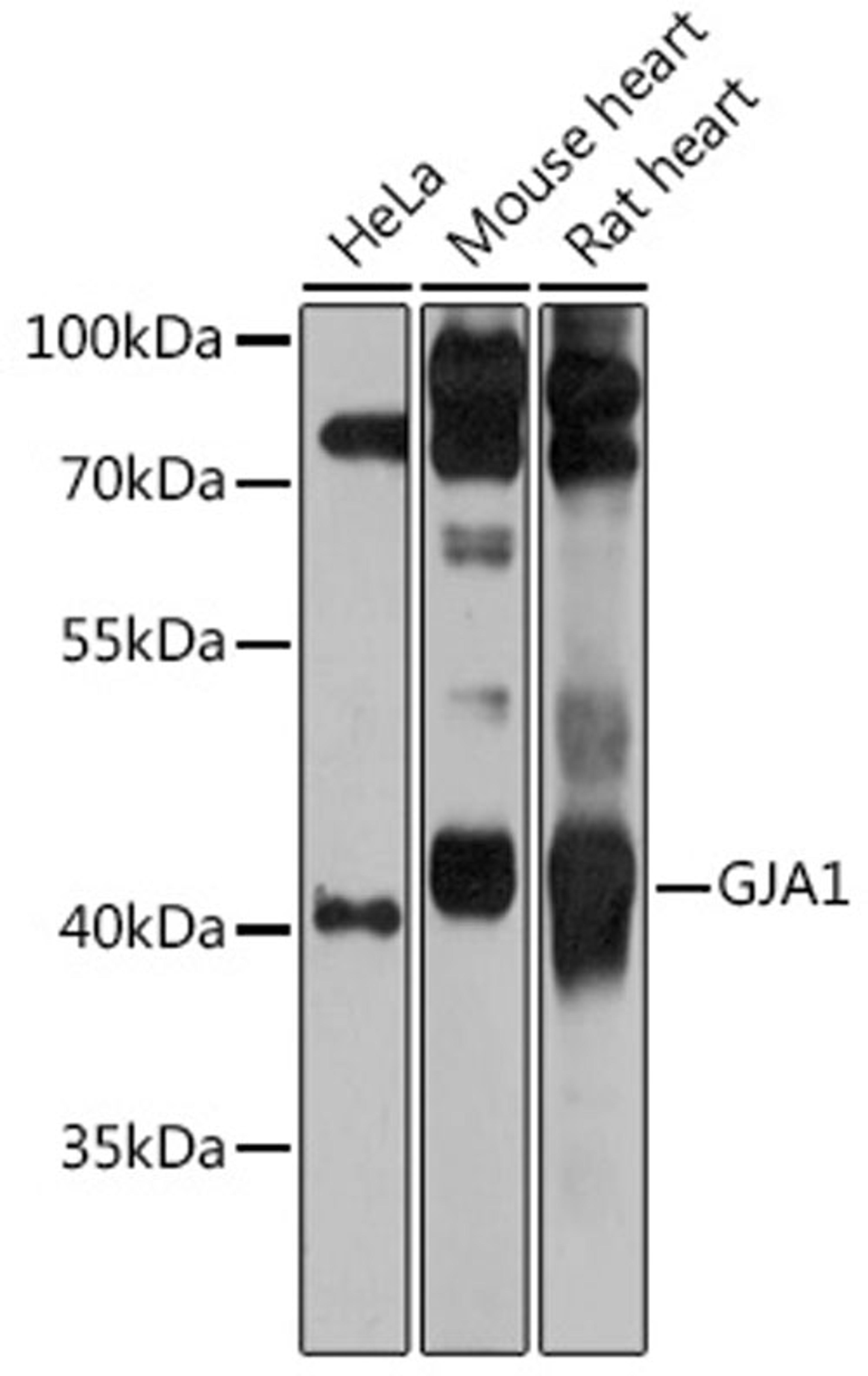 Western blot - GJA1 antibody (A11752)