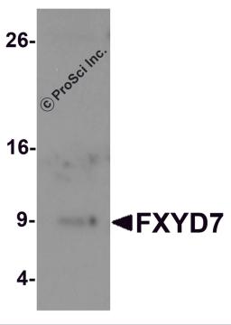 Western blot analysis of FXYD7 in human lung tissue lysate with FXYD7 antibody at 1 &#956;g/mL.