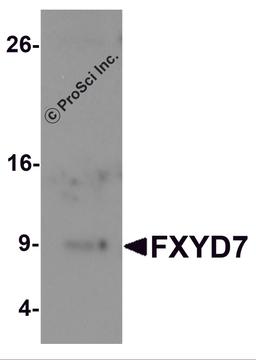 Western blot analysis of FXYD7 in human lung tissue lysate with FXYD7 antibody at 1 μg/mL.