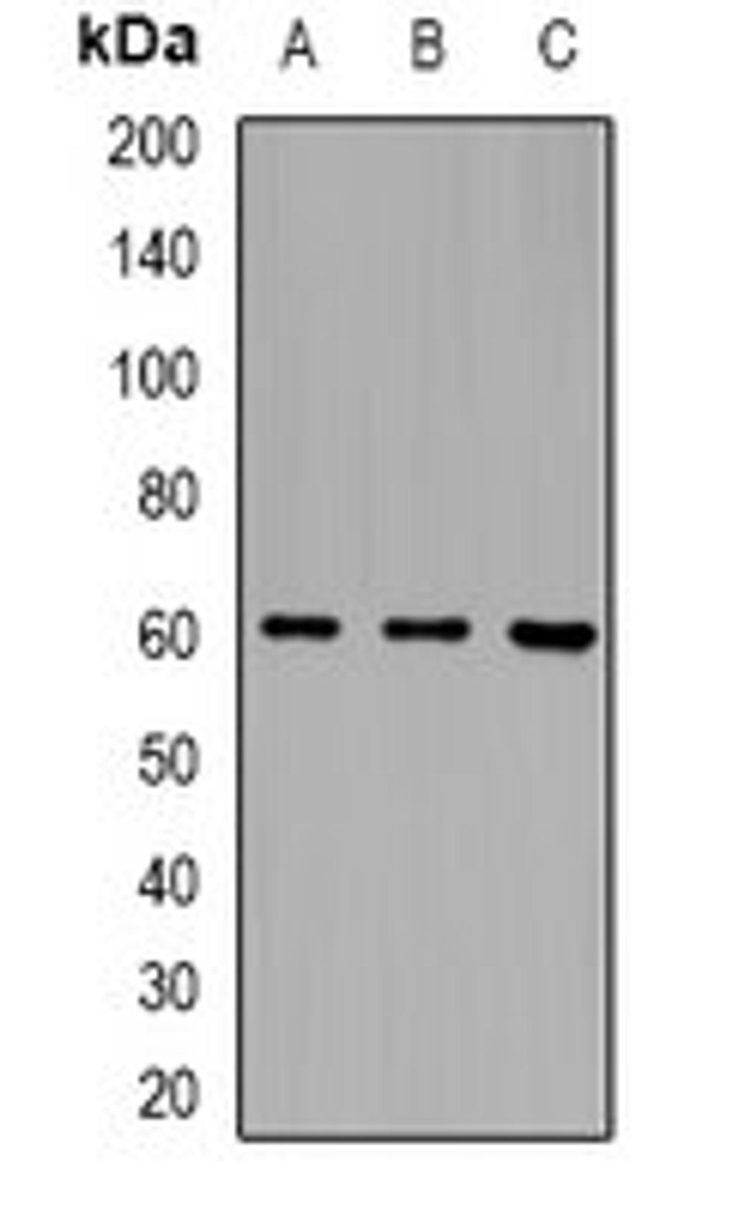 Western blot analysis of MCF7 (Lane1), mouse blood (Lane2), rat blood (Lane3) whole cell lysates using LILRB5 antibody