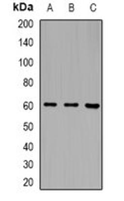 Western blot analysis of MCF7 (Lane1), mouse blood (Lane2), rat blood (Lane3) whole cell lysates using LILRB5 antibody